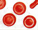 Эритроцит (красная клетка крови)