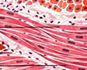 Миоцит (мышечная клетка)